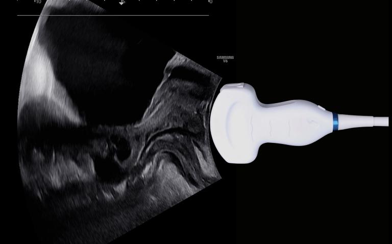 Sonographie_Beckenboden_Osteopathie_1