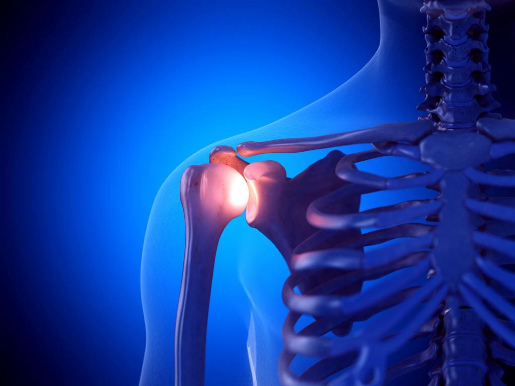 Die Frozen Shoulder